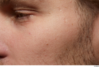 HD Arvid cheek eye face skin pores skin texture 0001.jpg